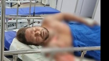 Um homem está sendo acusado de atear fogo na própria esposa durante uma briga, na madrugada desta segunda-feira (8), no bairro da Boca do Rio