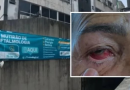 Pacientes relatam perda de visão após cirurgias de catarata e clínica é interditada em Salvador